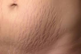 Skin Disease
